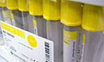 Urine Screens